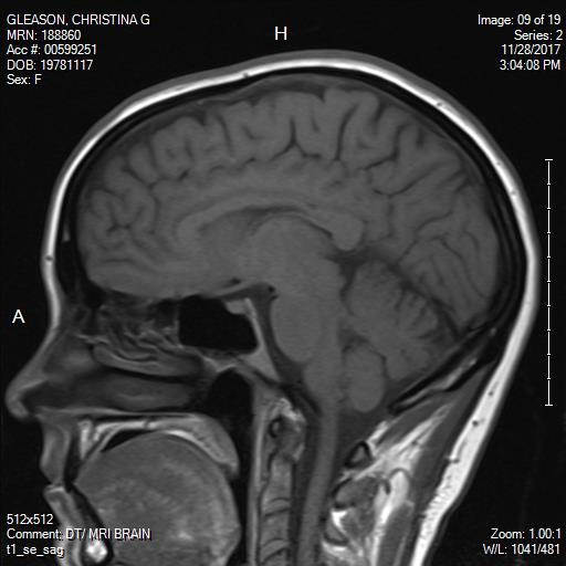Brain MRI profile